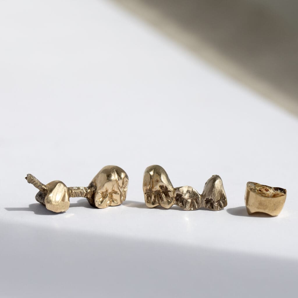 Gouden tanden